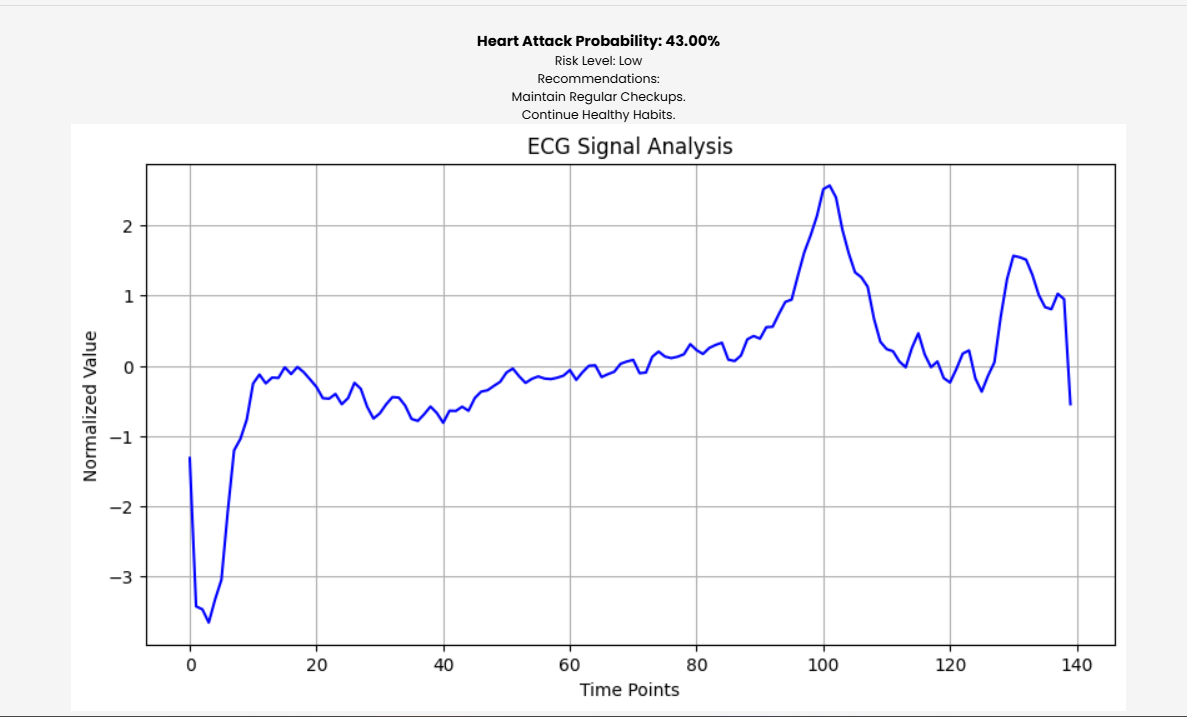 ECG Analysis